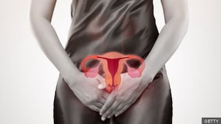 Derribando mitos del cáncer de cuello uterino