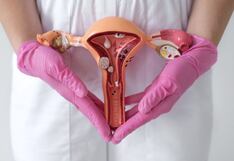 Cáncer de cuello uterino: medidas de prevención que debe conocer
