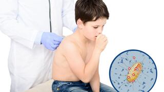 Cómo reducir el riesgo de tos ferina