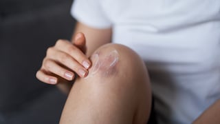 Hemofilia en Perú: más de 3 mil personas afectadas y solo el 30% cuenta con diagnóstico