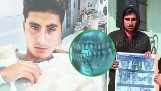 Termina con la mandíbula fracturada durante robo de su billetera (VIDEO)
