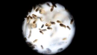 Zika: Confirman el primer caso autóctono y por transmisión sexual en EE.UU.