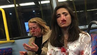 Pareja de lesbianas son golpeadas por cuatro hombres dentro de bus en Londres 