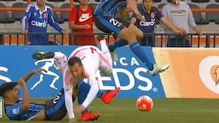 Futbolista chileno sufre aterradora fractura durante partido [VIDEO]