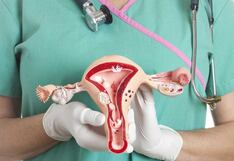 Recomendaciones esenciales para prevenir el cáncer de cuello uterino