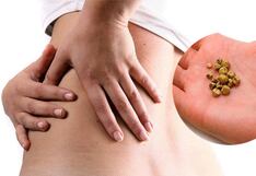 Riesgos de los cálculos biliares