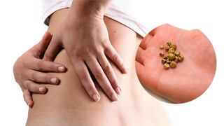 Riesgos de los cálculos biliares