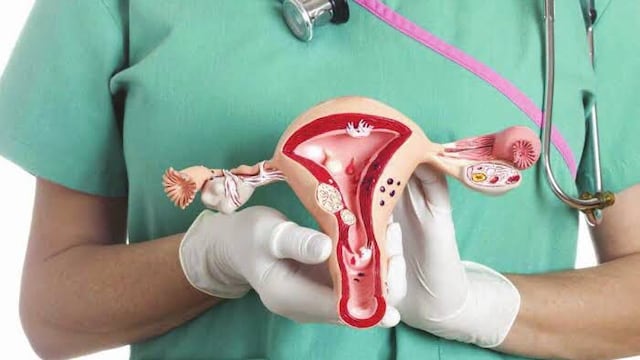 Cáncer de cuello uterino constituye la principal causa de muerte en las mujeres en el Perú
