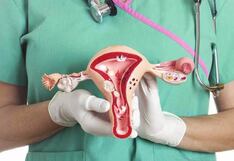Cáncer de cuello uterino constituye la principal causa de muerte en las mujeres en el Perú