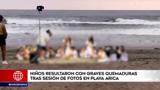 Lurín: dos niños sufren graves quemaduras en sesión fotográfica (VIDEO)