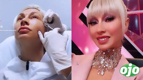 Belén Estévez se pone botox en el rostro - diario OJO