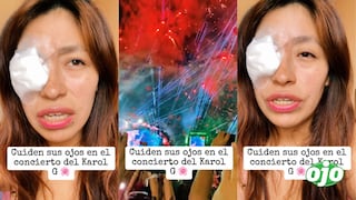 Joven sufre lesión ocular durante show de pirotécnicos en concierto de Karol G
