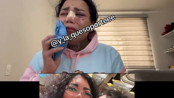 Ojo | Paola Suárez y su polémica confesión tras golpiza recibida por su novio: “El amor no se termina de un día para otro”