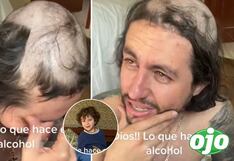 Llegó a su casa ebrio, se durmió y sus hijos lo dejaron pelado