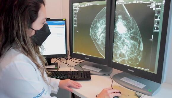 Día mundial contra el Cáncer de mama: Conoce la prevención y detección de esta neoplasia