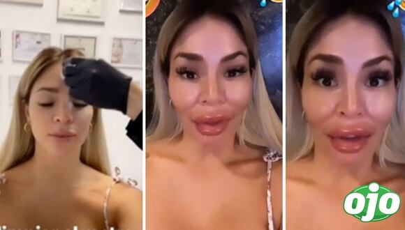 Sheyla Rojas usa divertido filtro | diario OJO