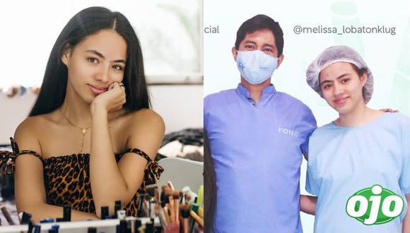 Cirujano de Melissa Lobaton habló de la operación - diario ojo