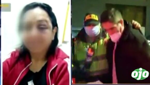 Diario OJO- Mujer fue desfigurada por su cuñado