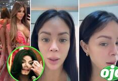 Así quedó la nariz de Sheyla Rojas tras nuevo ‘retoquito’: ¿No quedó conforme con el resultado?