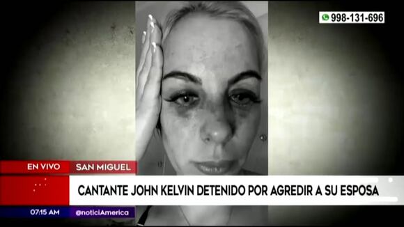 Federico Salazar sobre agresión a Dalia Duran