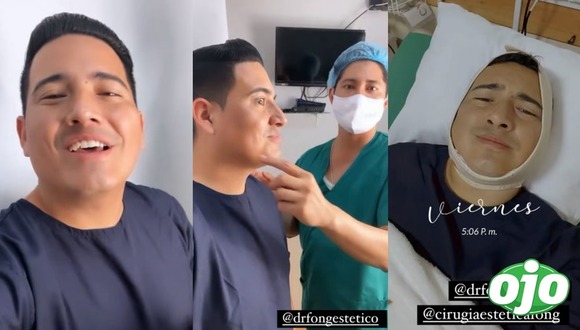 Instagram - Pedro Loli se hace operación en el rostro - diario OJO