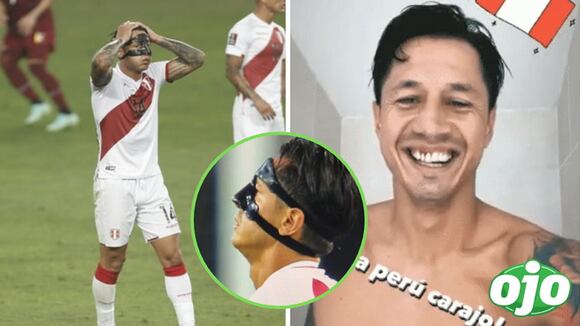 Gianluca Lapadula muestra cómo quedaron sus dientes tras ser golpeado en el partido | OJO