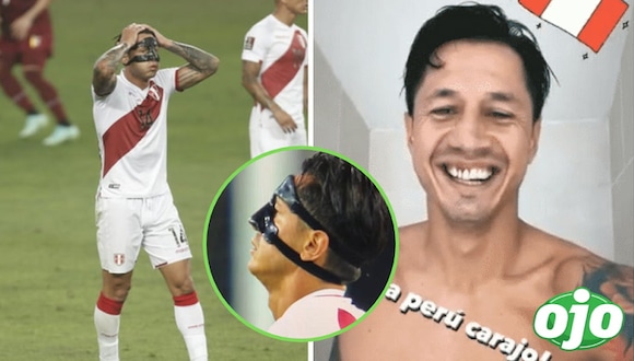 Gianluca Lapadula muestra cómo quedaron sus dientes tras ser golpeado en el partido | OJO