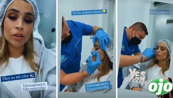 ojo | Ethel Pozo se pone ‘botox’ y comparte su experiencia