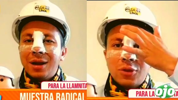 Ingeniero bailarín se somete a cirugías plásticas | diario OJO