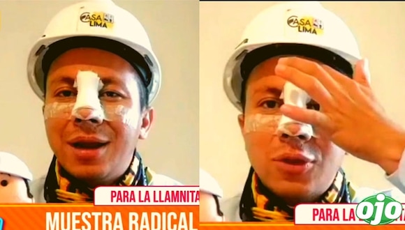 Ingeniero bailarín se somete a cirugías plásticas | diario OJO