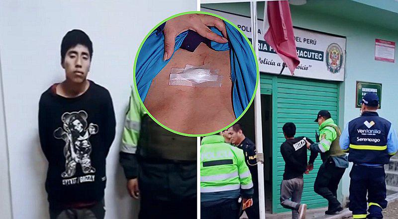 Escolar de 14 años es acuchillado para robarle su mochila en Ventanilla | VIDEO