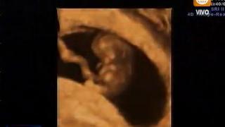 Sully Sáenz mostró la primera ecografía de su bebé [FOTO] 