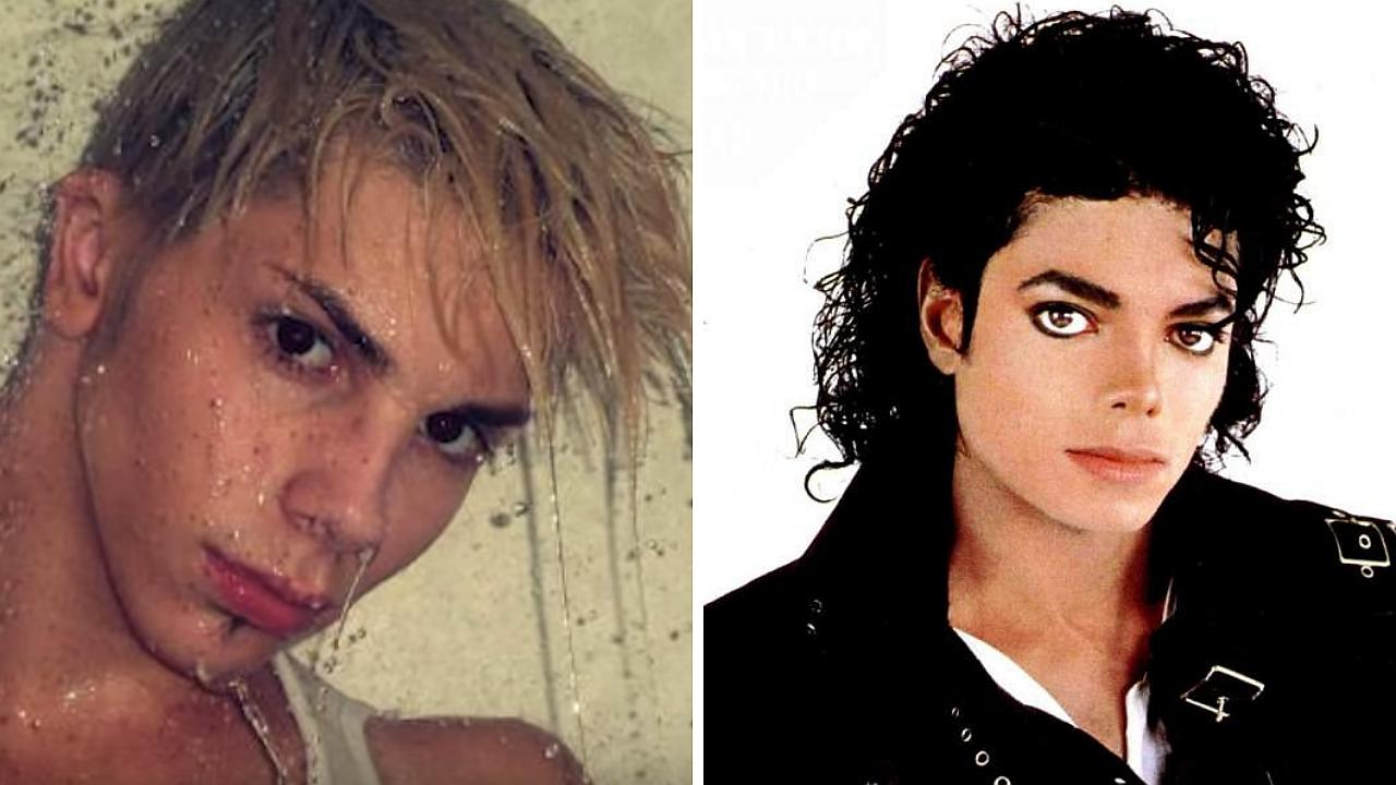 Joven gasta 33 mil dólares en cirugías plásticas para parecerse a Michael Jackson y este es el resultado (FOTOS)