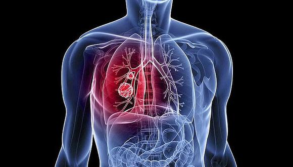​Pulmones dañados podrán ser regenerados con retiro de células enfermas