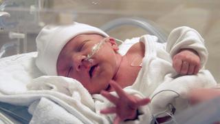¿Cuáles son las complicaciones graves que presenta un bebé prematuro?