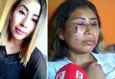 Mujer quedó con el rostro desfigurado tras brutal agresión de su expareja delante de su hija de 2 años | VIDEO 