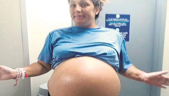 Mujer con enorme barriga da a luz a bebé de 6 kilos y sin cesárea