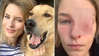 Modelo rescata a perro callejero y semanas después la ataca y le desfigura el rostro de un mordisco | FOTO