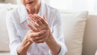 Terapias biológicas para la artritis psoriásica y reumatoide evitan que pacientes crónicos sufran discapacidad