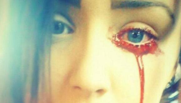 Adolescente de 17 años llora sangre y nadie da con su mal [VIDEO] 