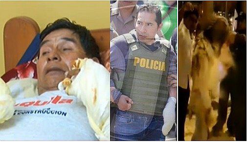 Pasajero sordomudo necesita ayuda por fuertes quemaduras tras ataque en bus