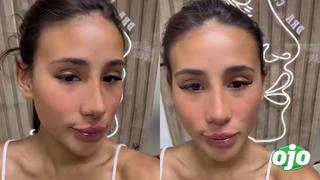 Samahara Lobatón se hace nuevos ‘retoquitos’ en la cara: “amé mi rinomodelación y labios” | VIDEO