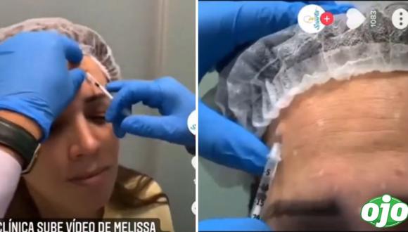 Melissa Klug: filtran video de ella aplicándose botox para disimular las arrugas