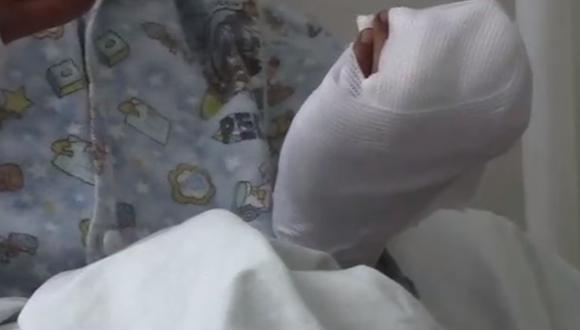 Menor perdió dos dedos tras el infortunado incidente. (Foto: captura | redes sociales)