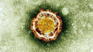 Alerta por nuevo virus de neumonía: OMS convoca comité de emergencia por misterioso coronavirus