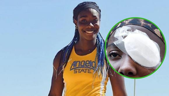 Le tiran huevazos en ojo de atleta nigeriana y tuvo que ser operada de emergencia
