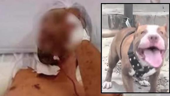 Entró a robar a una casa pero es atacado por pitbull y ¡pierde un brazo! (VIDEO)