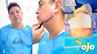Leonard León se hace cirugías en la cara y deja en shock con cambio radical | VIDEO