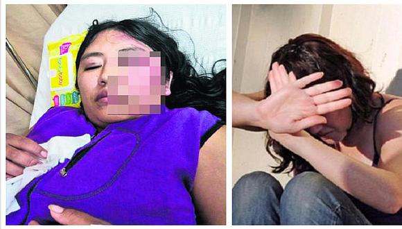 #UnidosPorTodas: mujer recibe tremenda golpiza de su pareja frente a su hijo de 6 años
